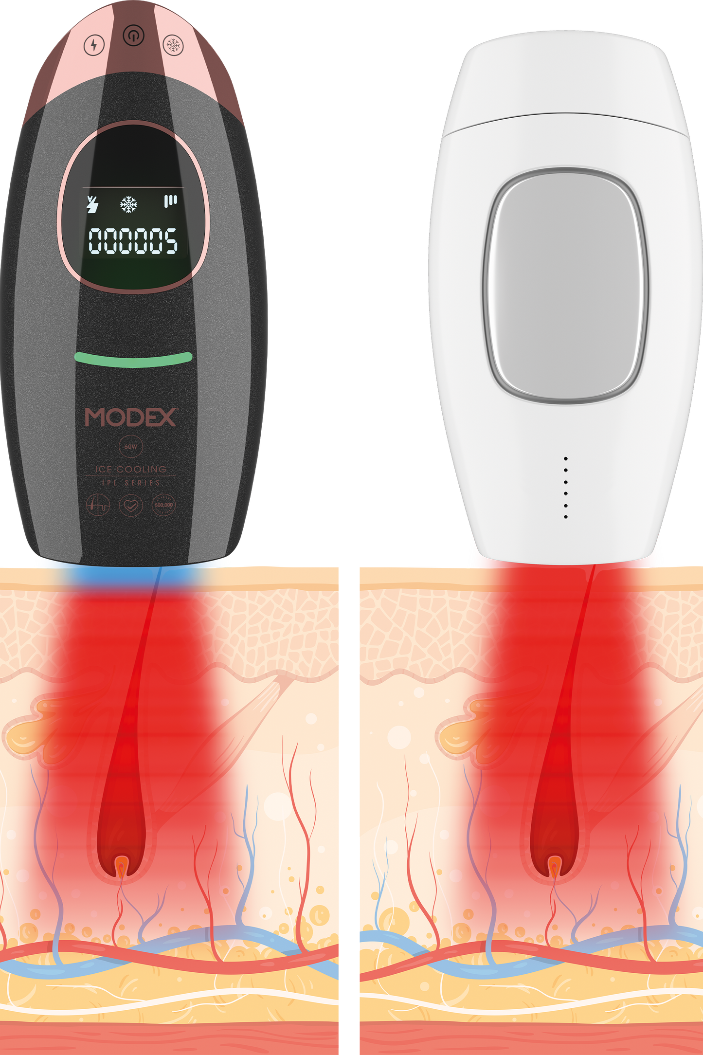 موديكس إزالة الشعر بالليزر Ipl1000